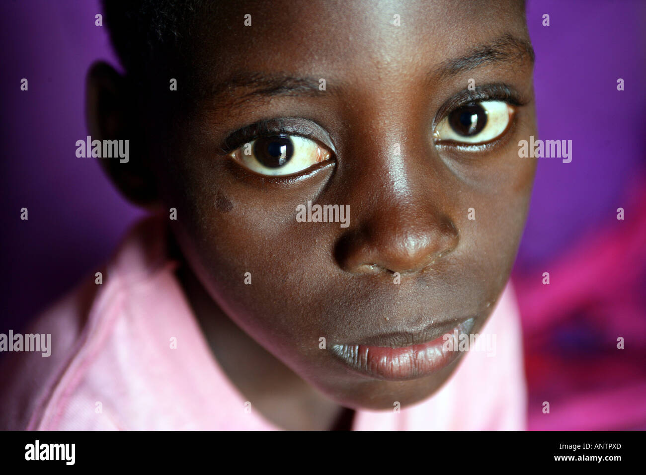 HIV orphan in Tanzania Stock Photo