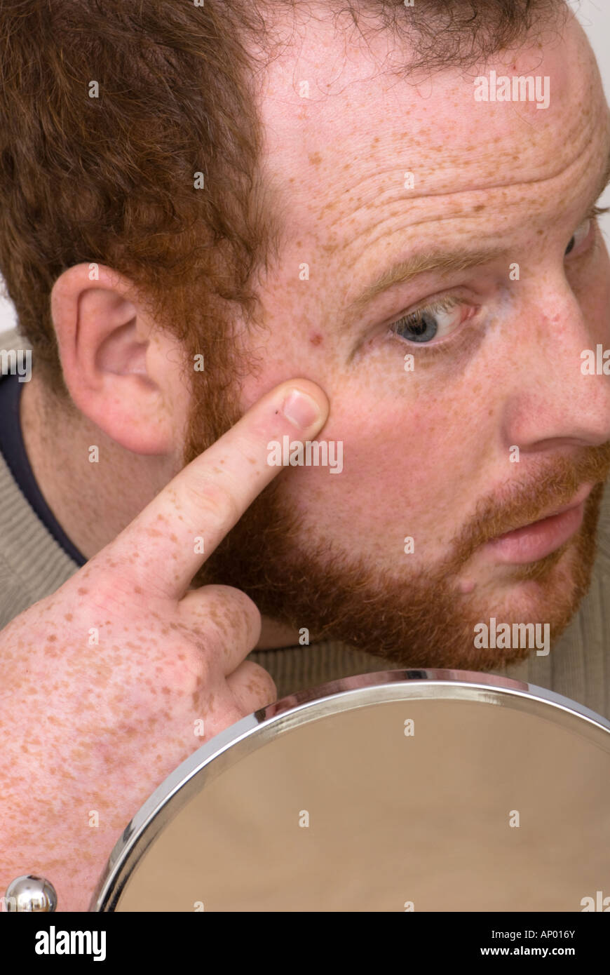 man looking in a mirror at spot zit pimple whitehead on his face Stock ...