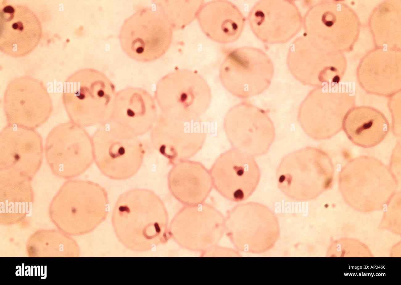 Science Micro Malaria parasite Stock Photo - Alamy