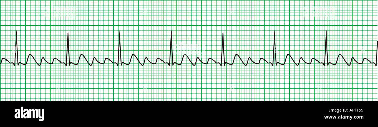ECG electrocardiogram Stock Photo