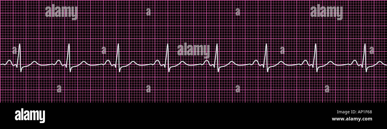 Normal ecg hi-res stock photography and images - Alamy