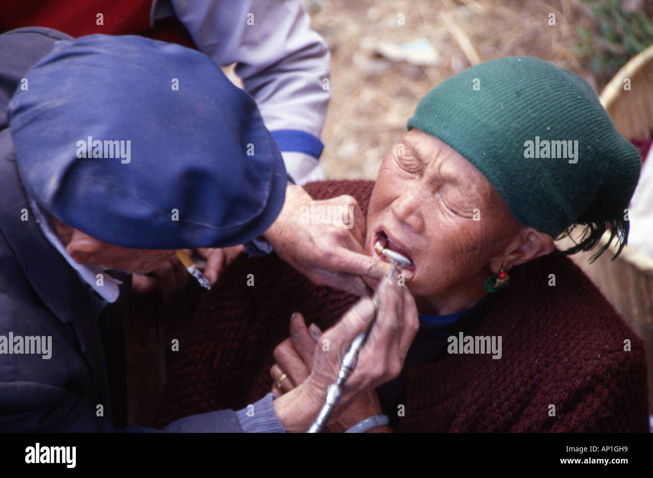 local dentist working on a local womans teeth shaping market yunnan province china Stock Photo