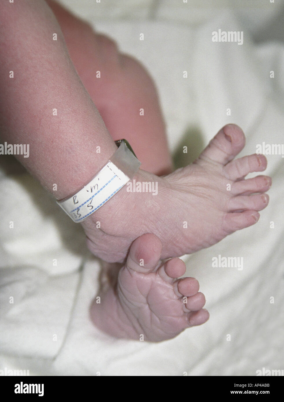 Baby hospital id bracelet hi-res stock photography and images - Alamy