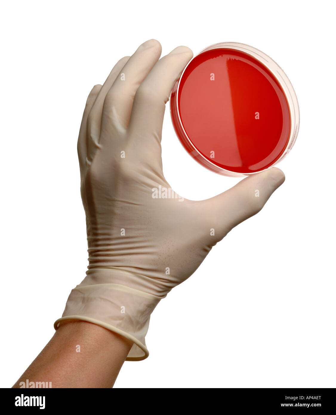 Hand holding a petri dish with blood agar Stock Photo