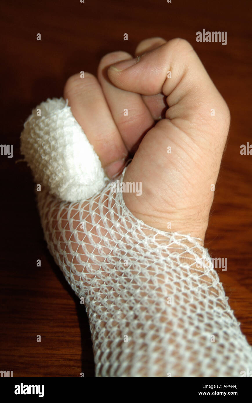 Wounded hand bandaged Stock Photo