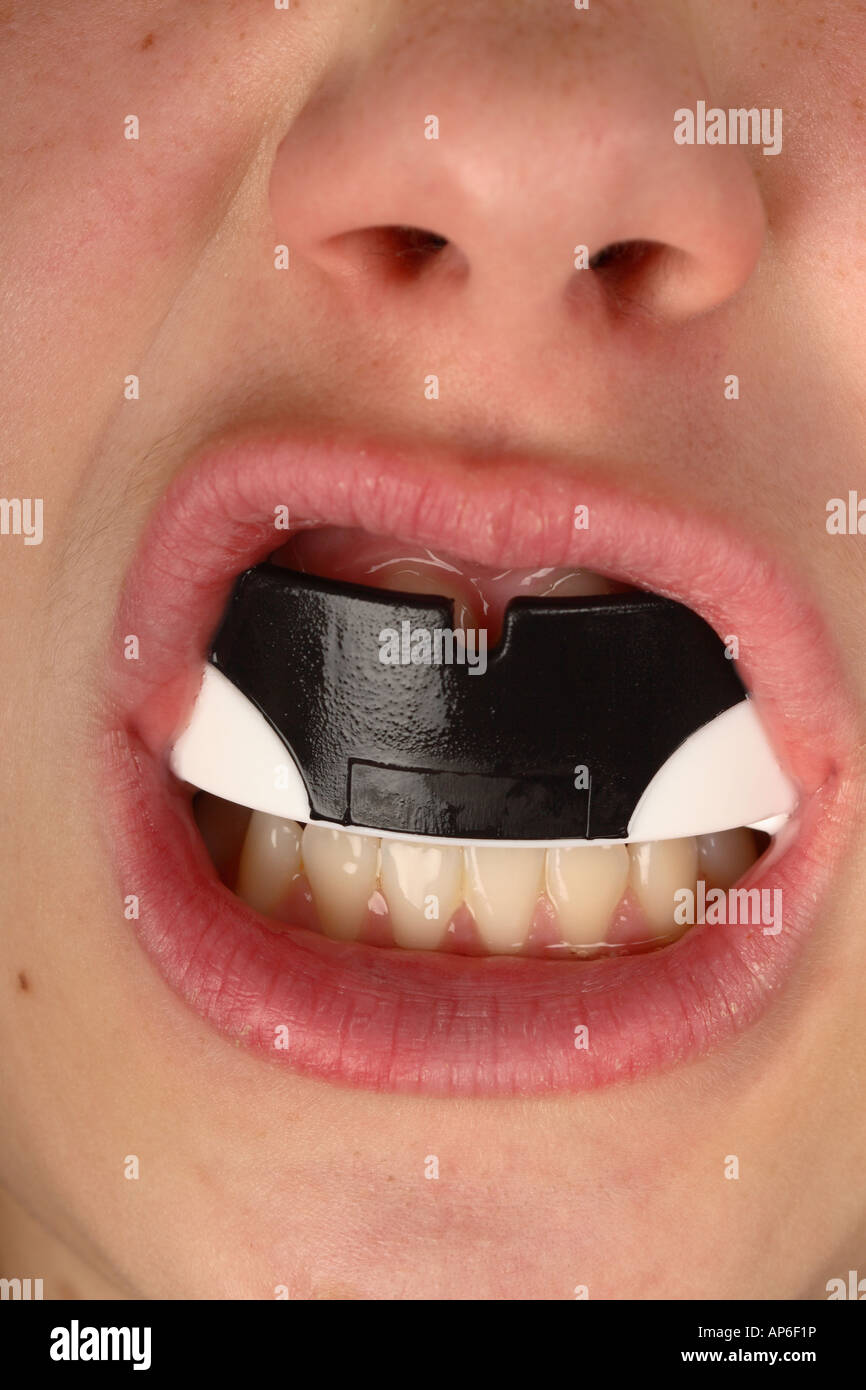 UK Warrior Men Women Gum Shield MMA Martial Arts Mouth Guard Teeth Protection 