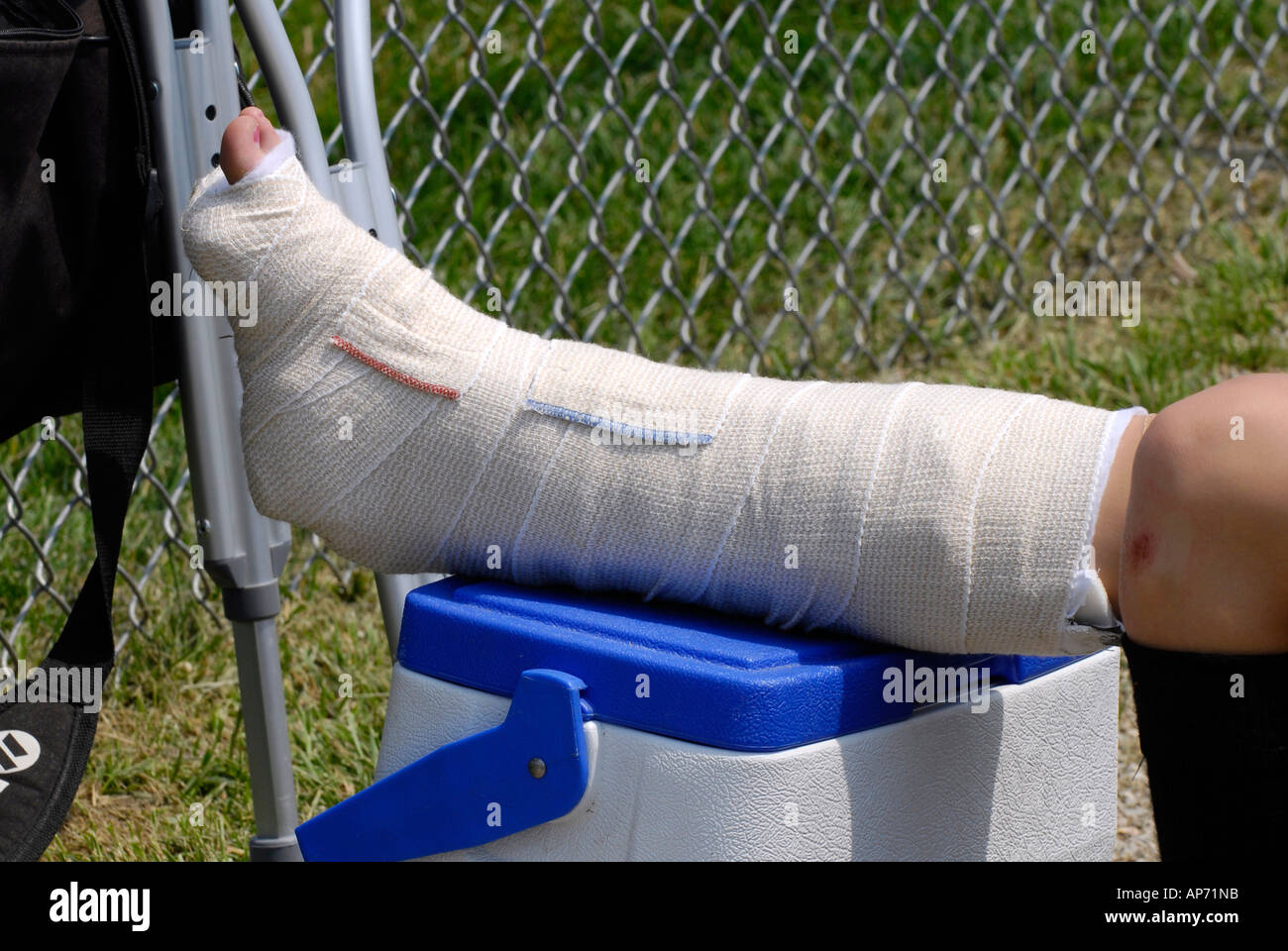 Female softball player sprains ankle from Sports injury due to playing