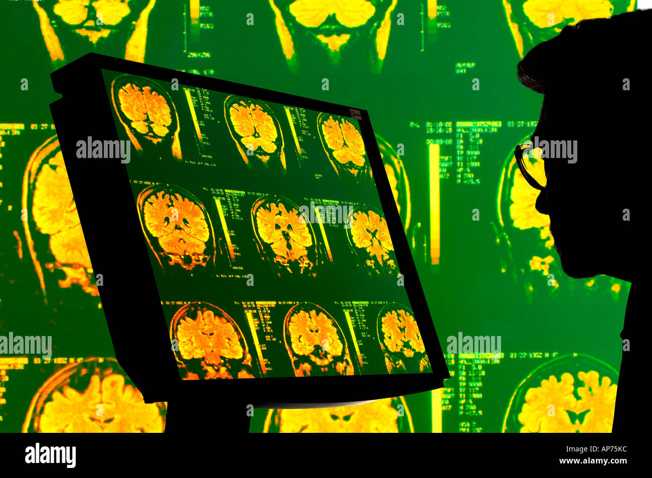medical doctor with MRI medical image on monitor and background Stock Photo