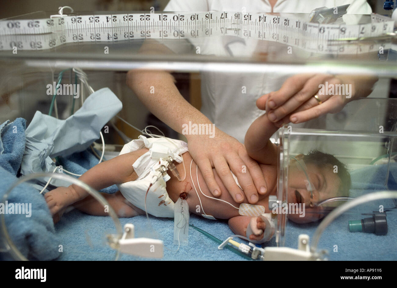 neonatal baby lying in incubator Stock Photo