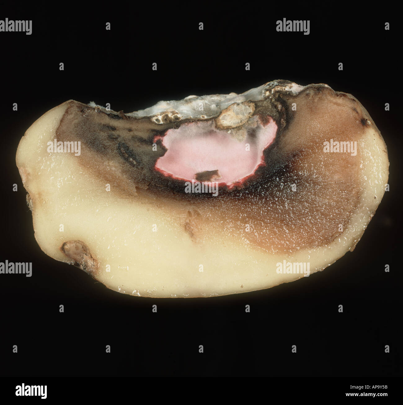 Dry rot Fusarium spp potato section showing extent of the rot and pink mycelium Stock Photo