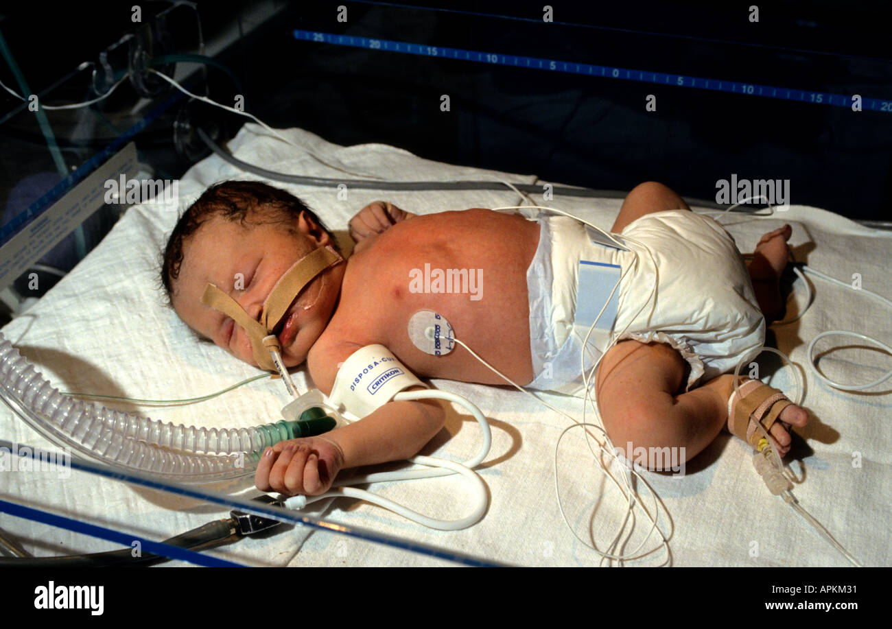 incubator premature baby Stock Photo Alamy