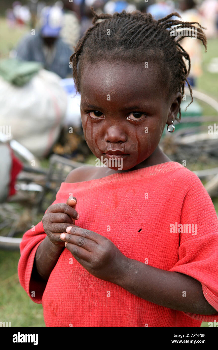 A tear stained child at a refugee camp, Afhara Stadium, Nakuru, Kenya, East Africa Stock Photo