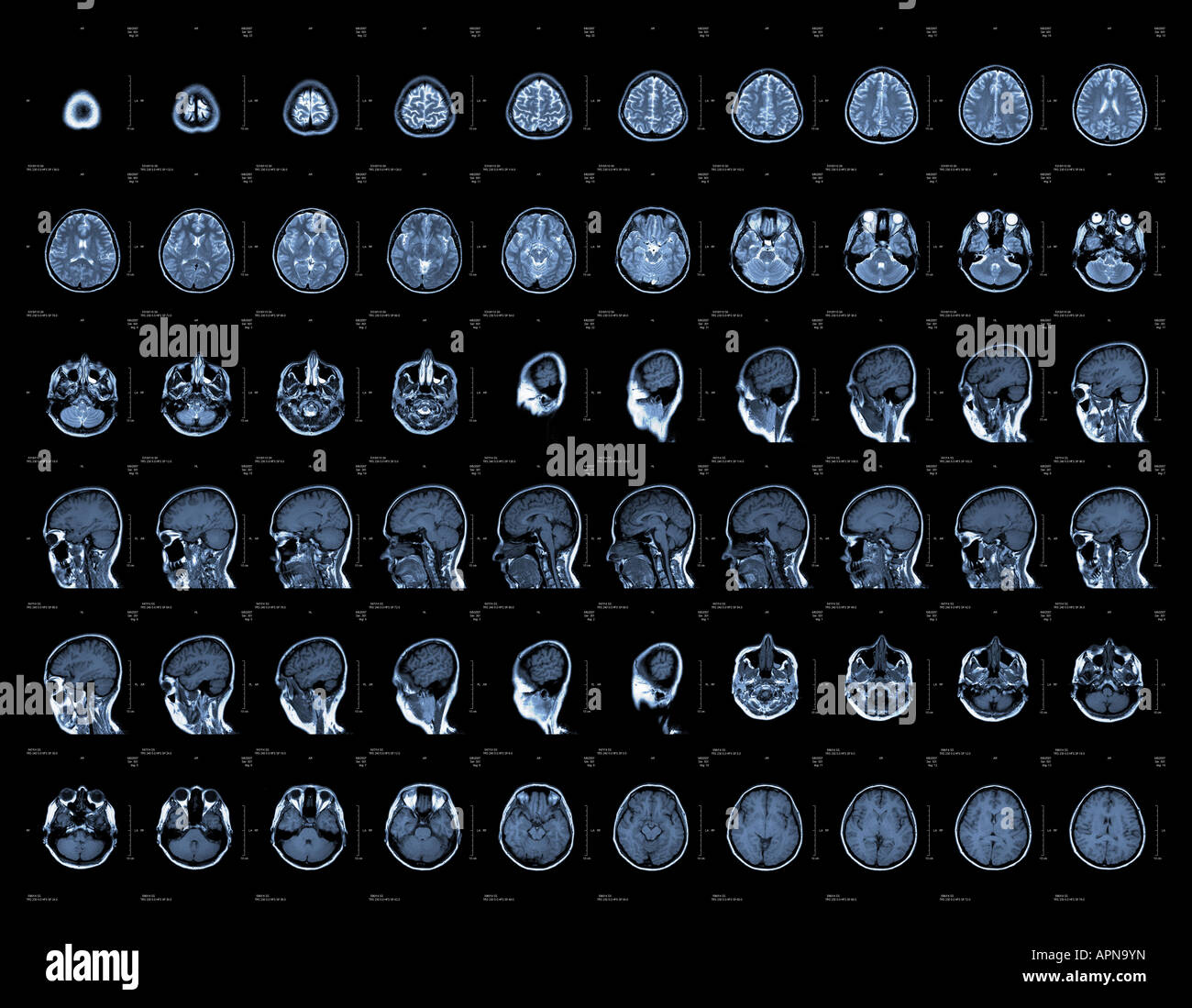 Brain and head MRI or CT images Stock Photo