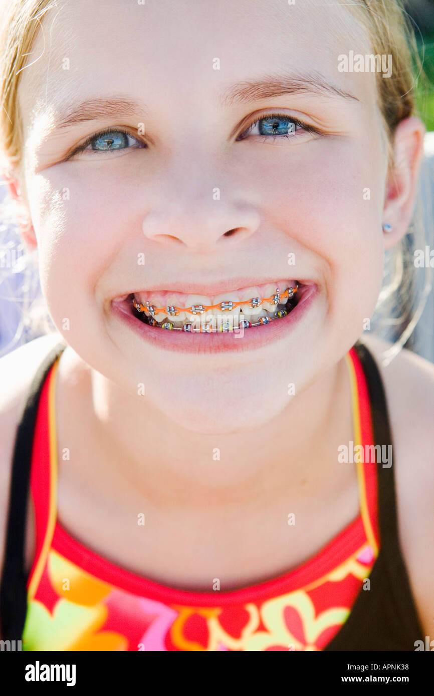 Girl showing off her braces Stock Photo - Alamy