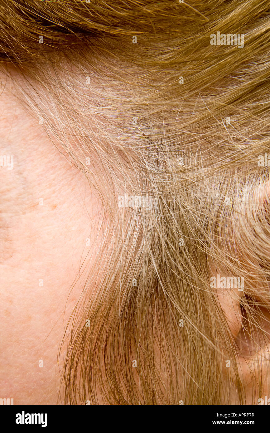Hair roots grey hi-res stock photography and images - Alamy