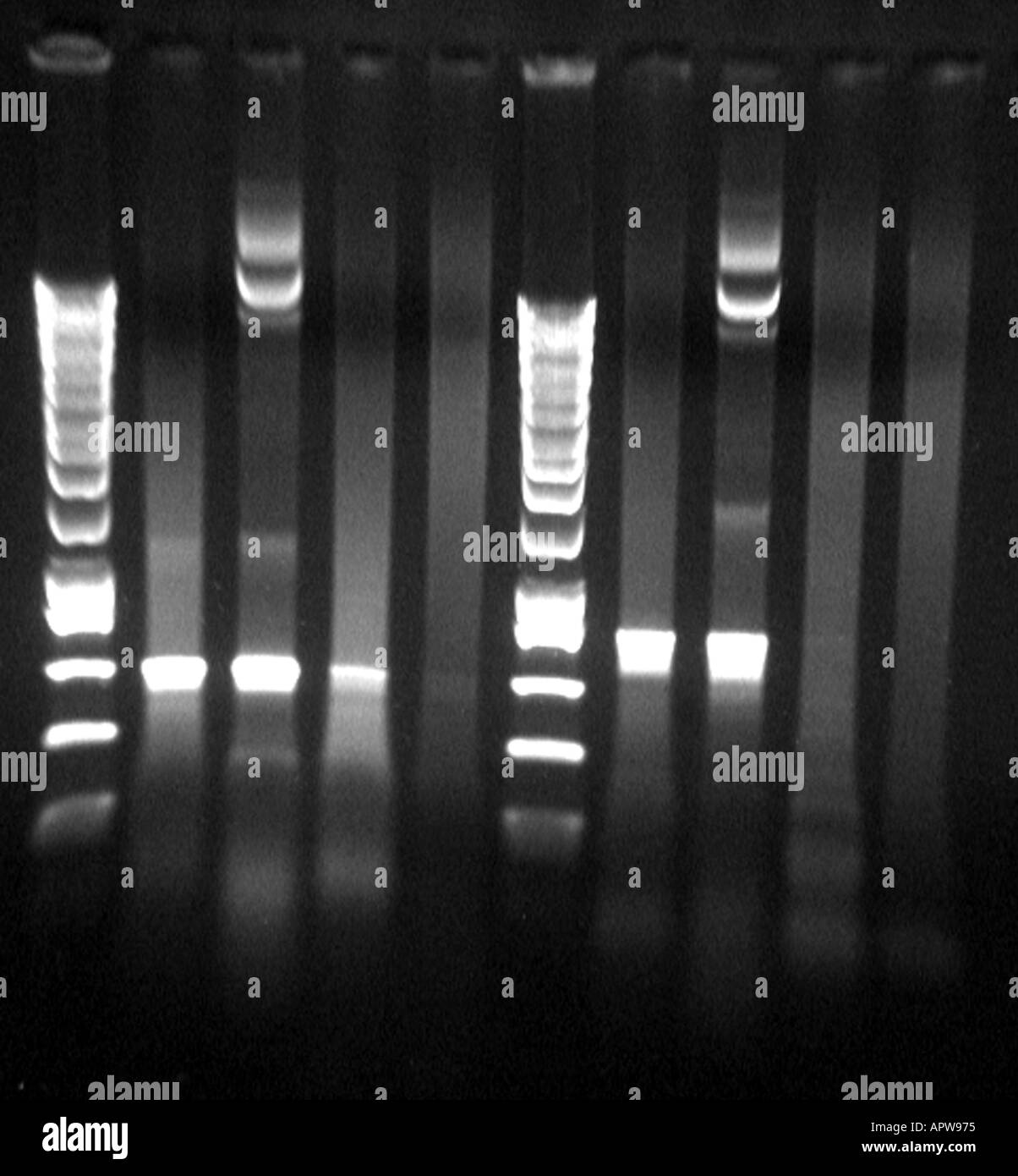 DNA electrophoresis Stock Photo Alamy
