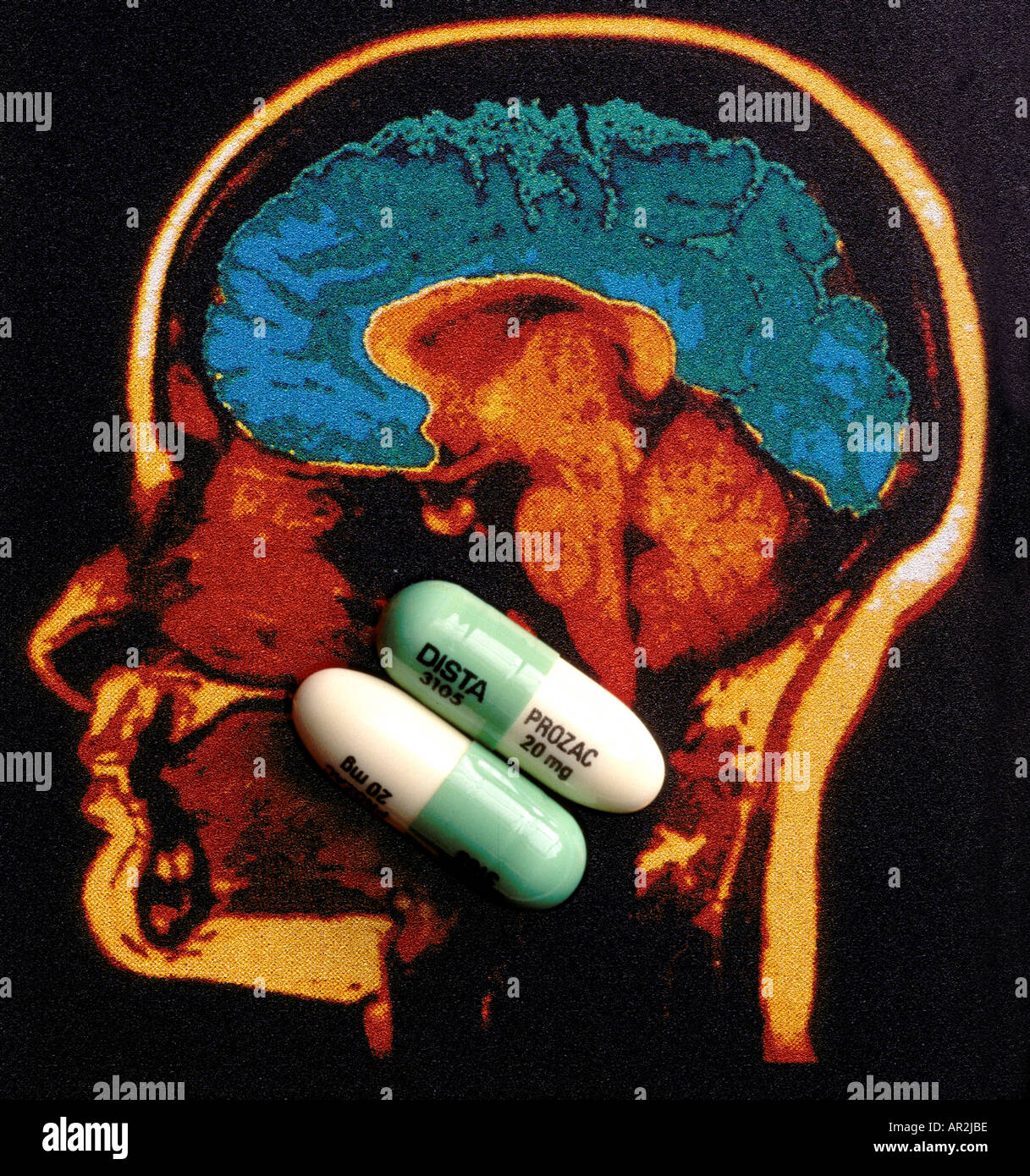 prozac 20 mg capsules produced by Dista superimposed on a scan of the human head and brain Stock Photo