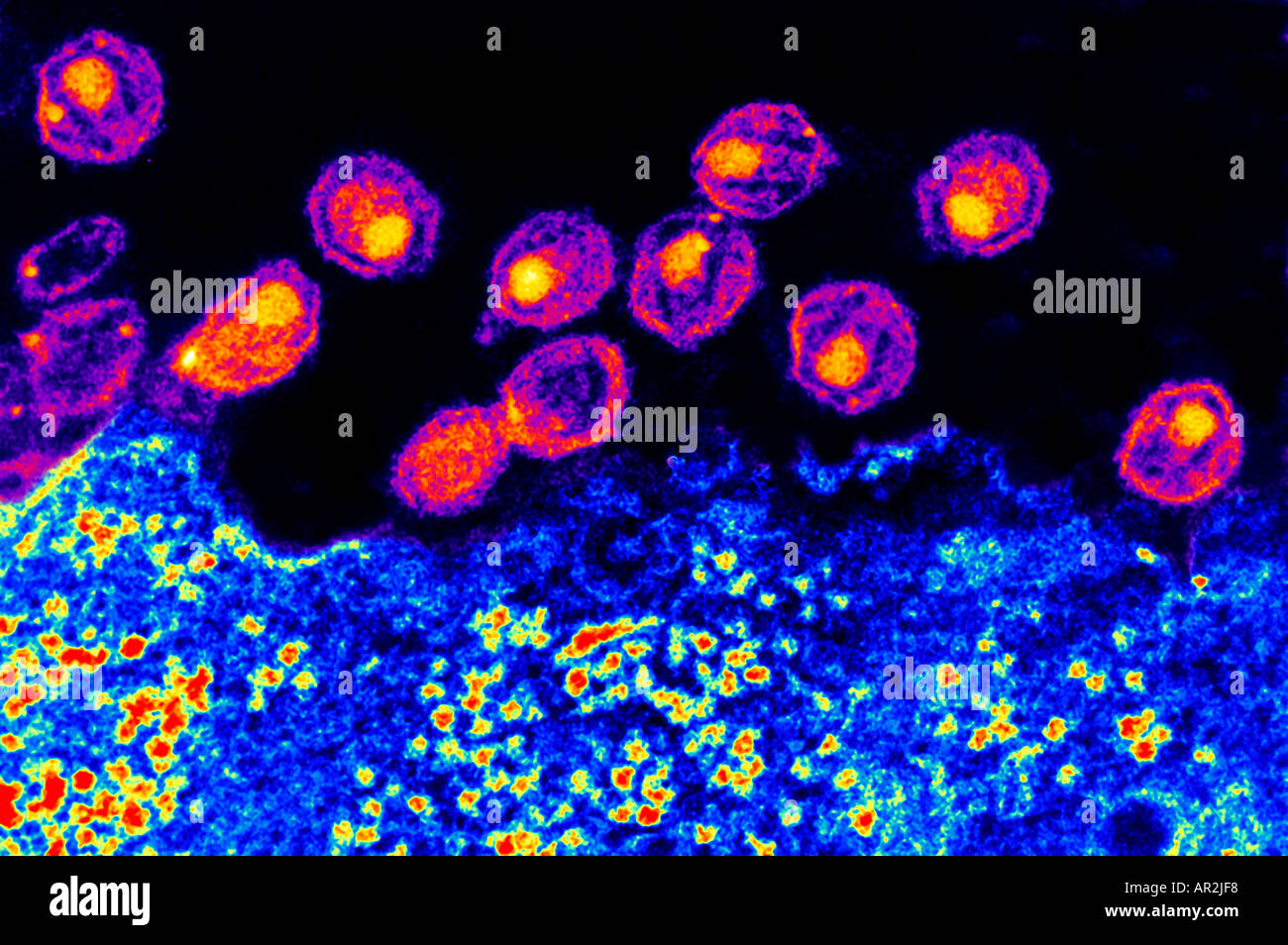 electron microscopy hiv