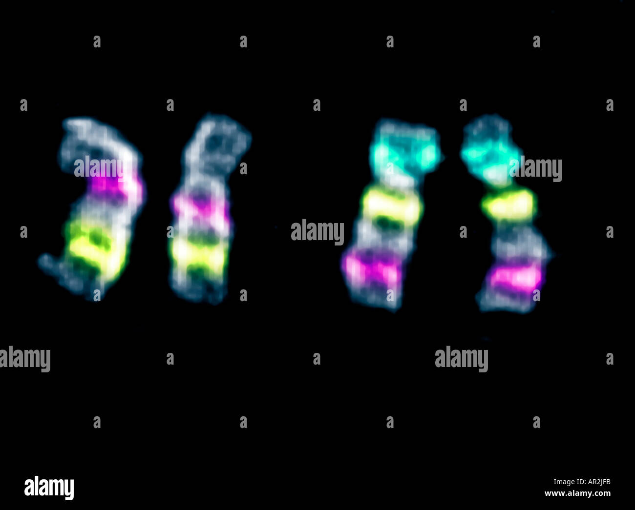 Human chromosomes stained and digitally enhanced to emphasize the banding patterns Chromosomes 8 9 and 10 Stock Photo