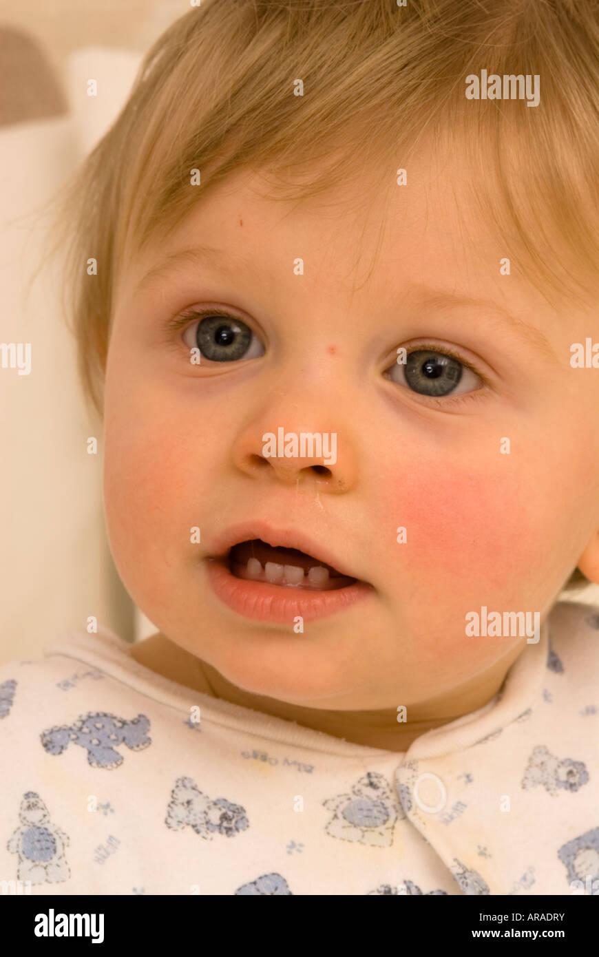 One year old baby boy teething showing teeth and mucus and runny sore