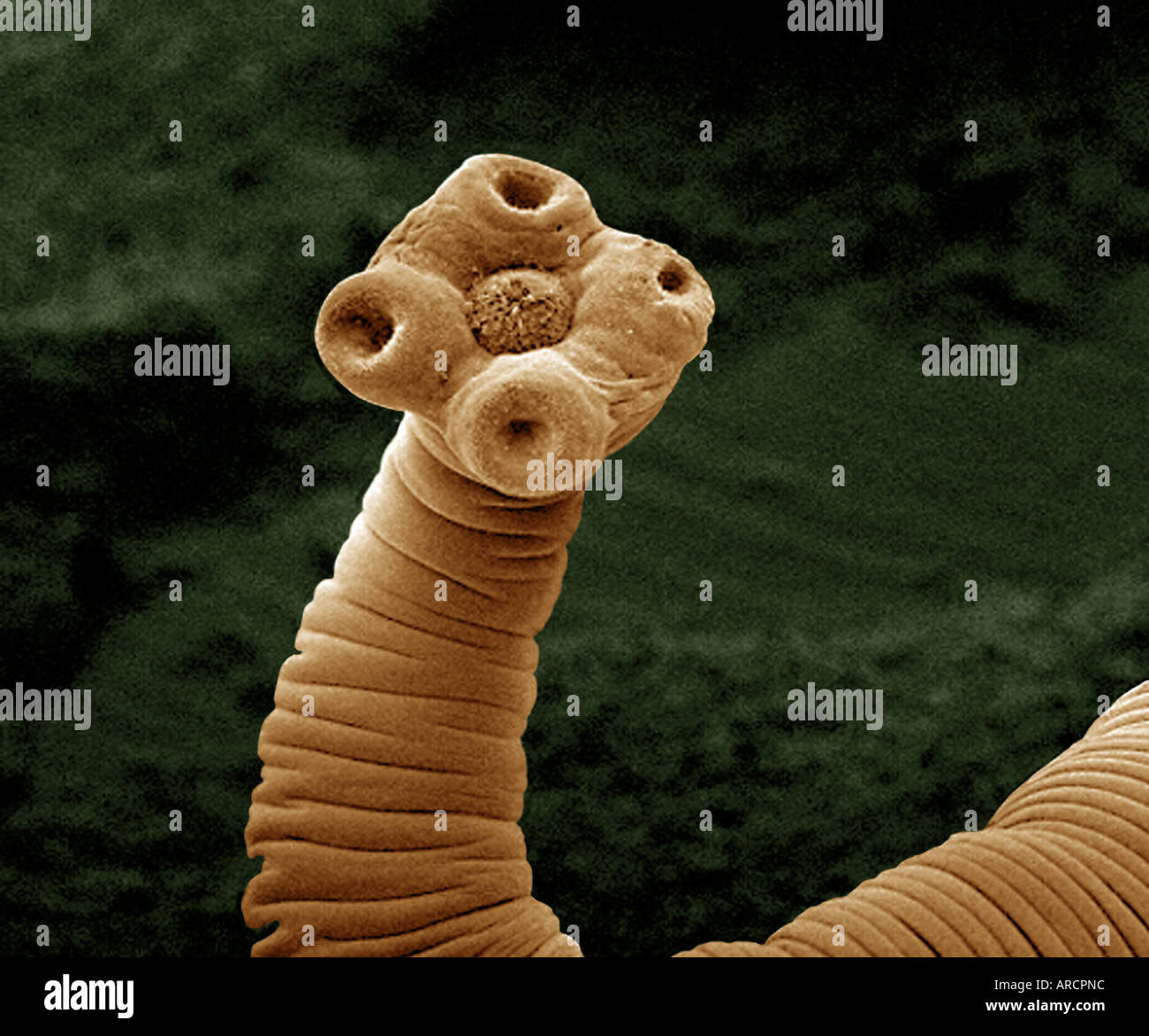 tapeworm under a microscope