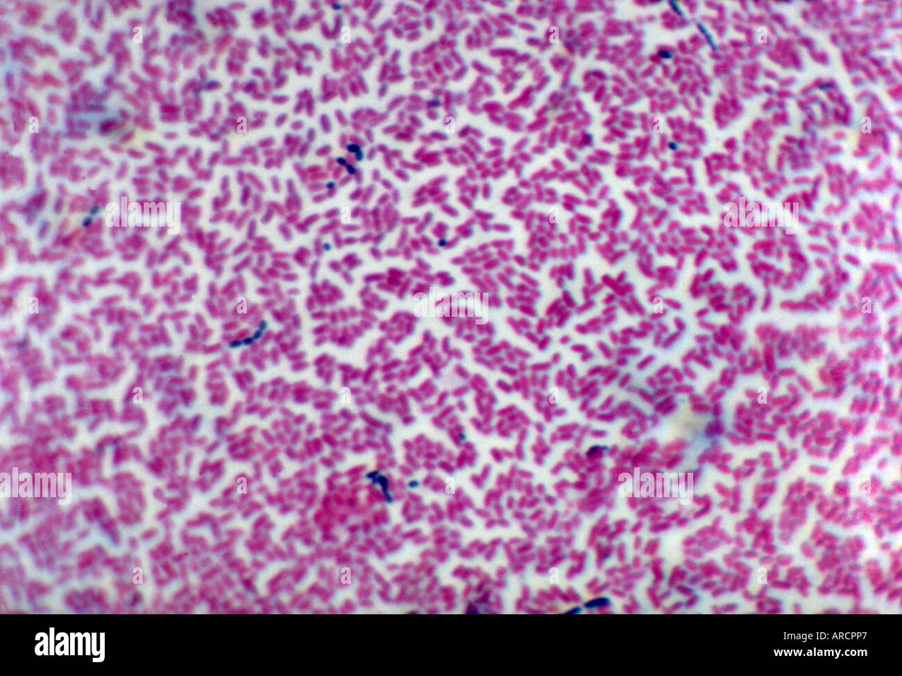 A photomicrograph of Klebsiella bacteria in human tissue Stock Photo