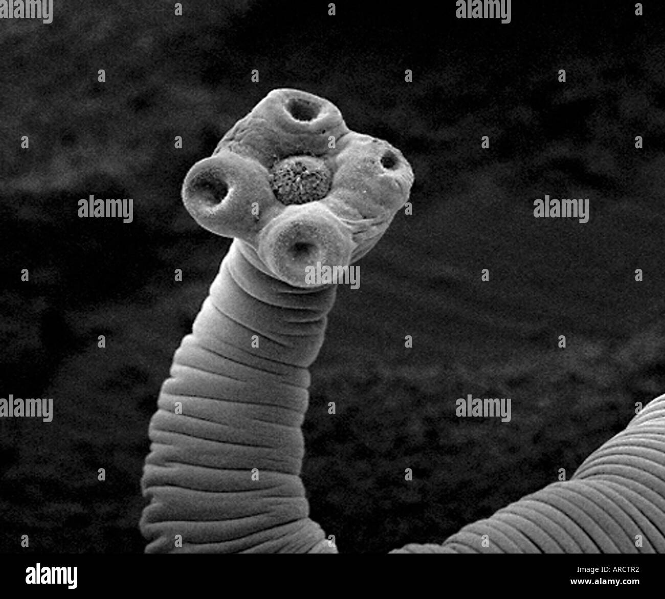 Tapeworm hires stock photography and images Alamy