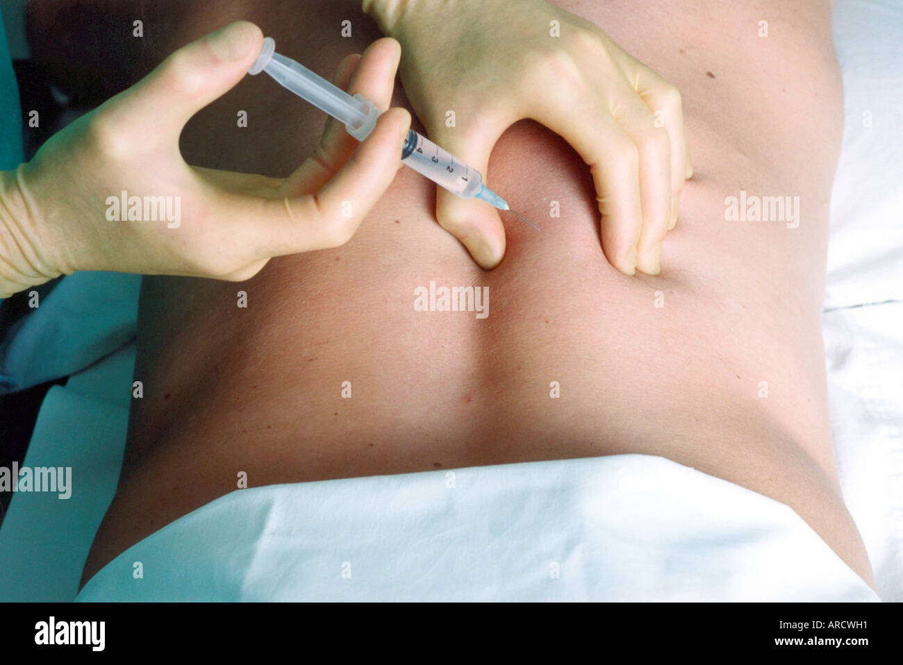 Intramuscular injection Stock Photo