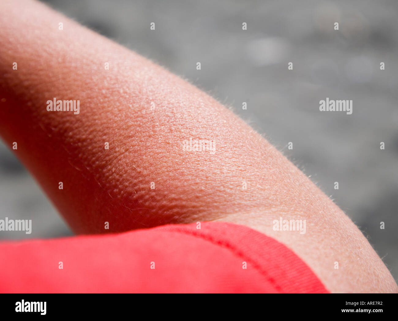 Goose bumps hires stock photography and images Alamy