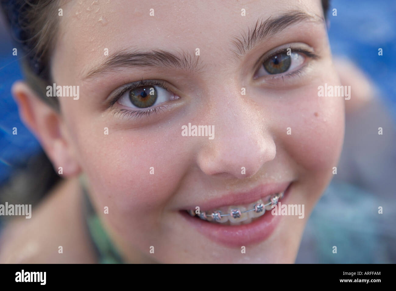 Young Girl Smiling With Braces In Swimming Pool Stock Photo Alamy