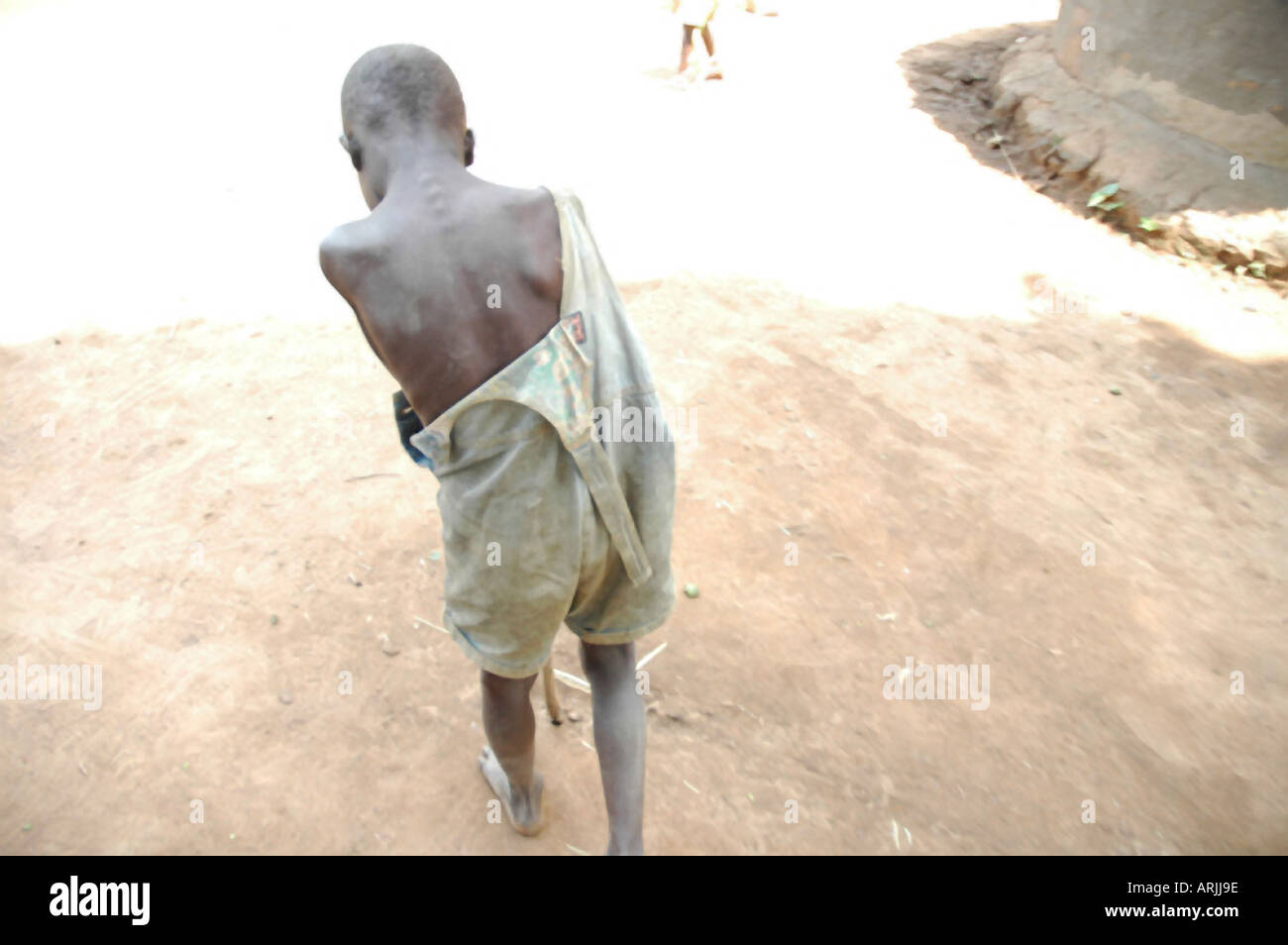 Boy in goverment camp in Uganda Stock Photo