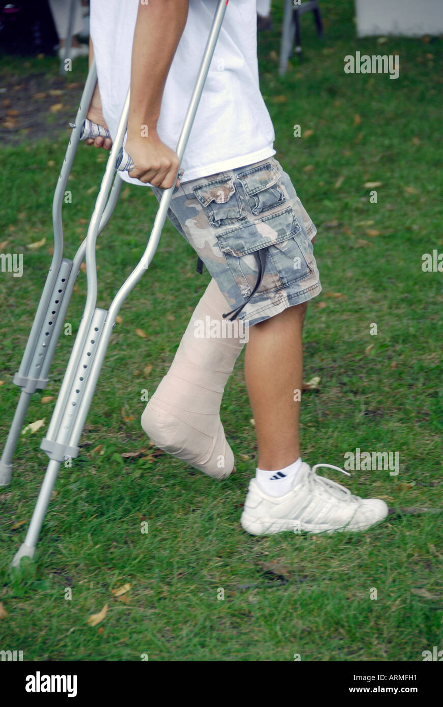 Boy with injured ankle walking on crutches Stock Photo Alamy Boy with injured ankle walking on crutches Stock Photo Alamy
