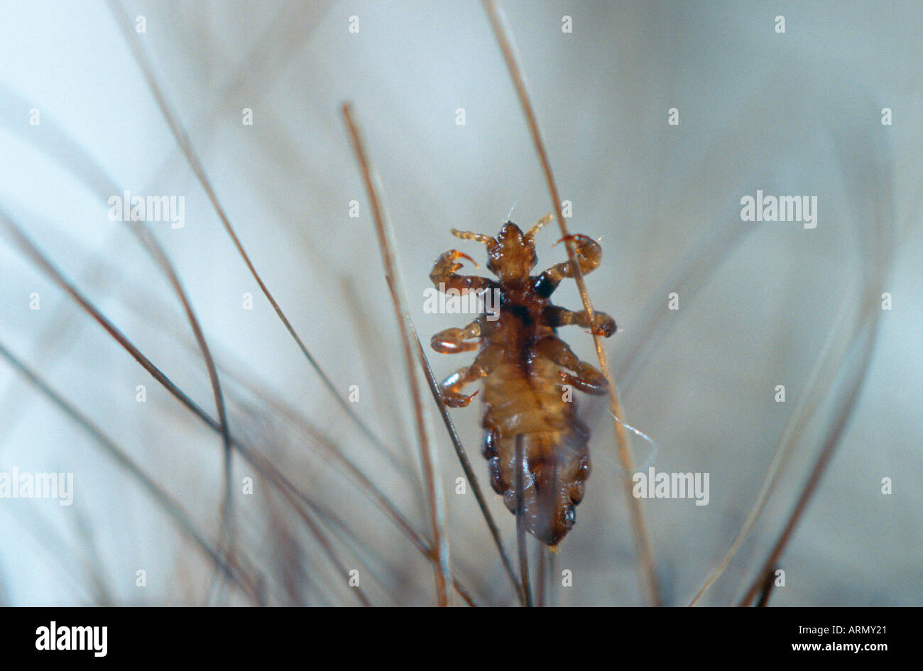 head louse (Pediculus capitis, Pediculus humanus capitis), imago amongst human hair. Stock Photo