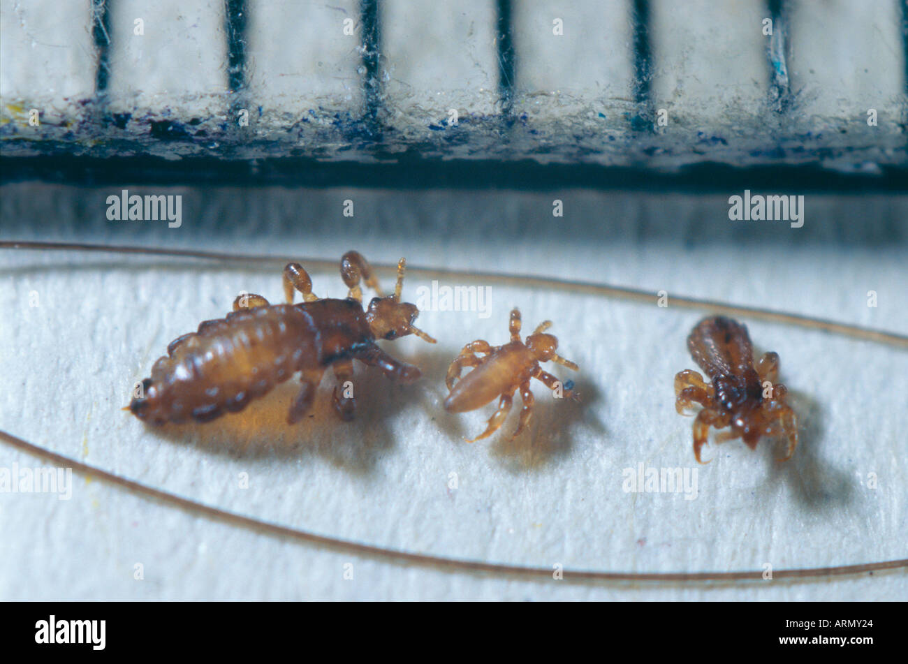 head louse (Pediculus capitis, Pediculus humanus capitis), imago amongst human hair. Stock Photo