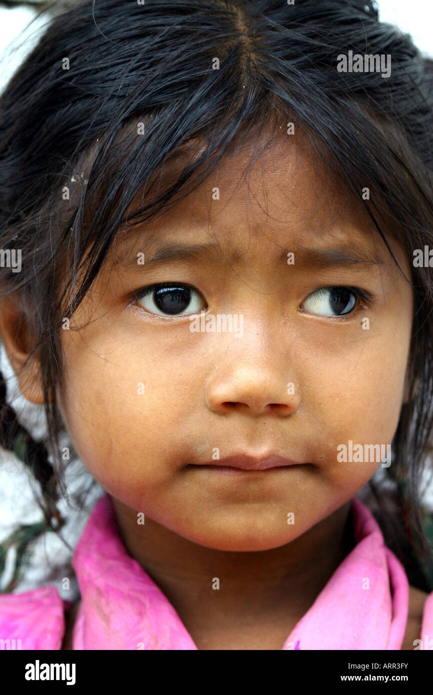 '8 year old Samjhana from Nepal who has strabismus or lazy eye' Stock Photo