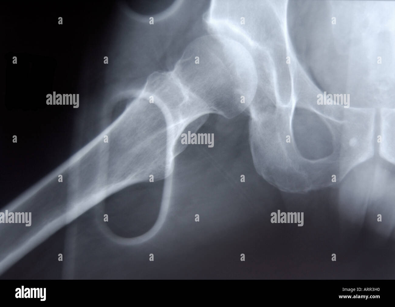 lateral xray of single adult hip Stock Photo Alamy