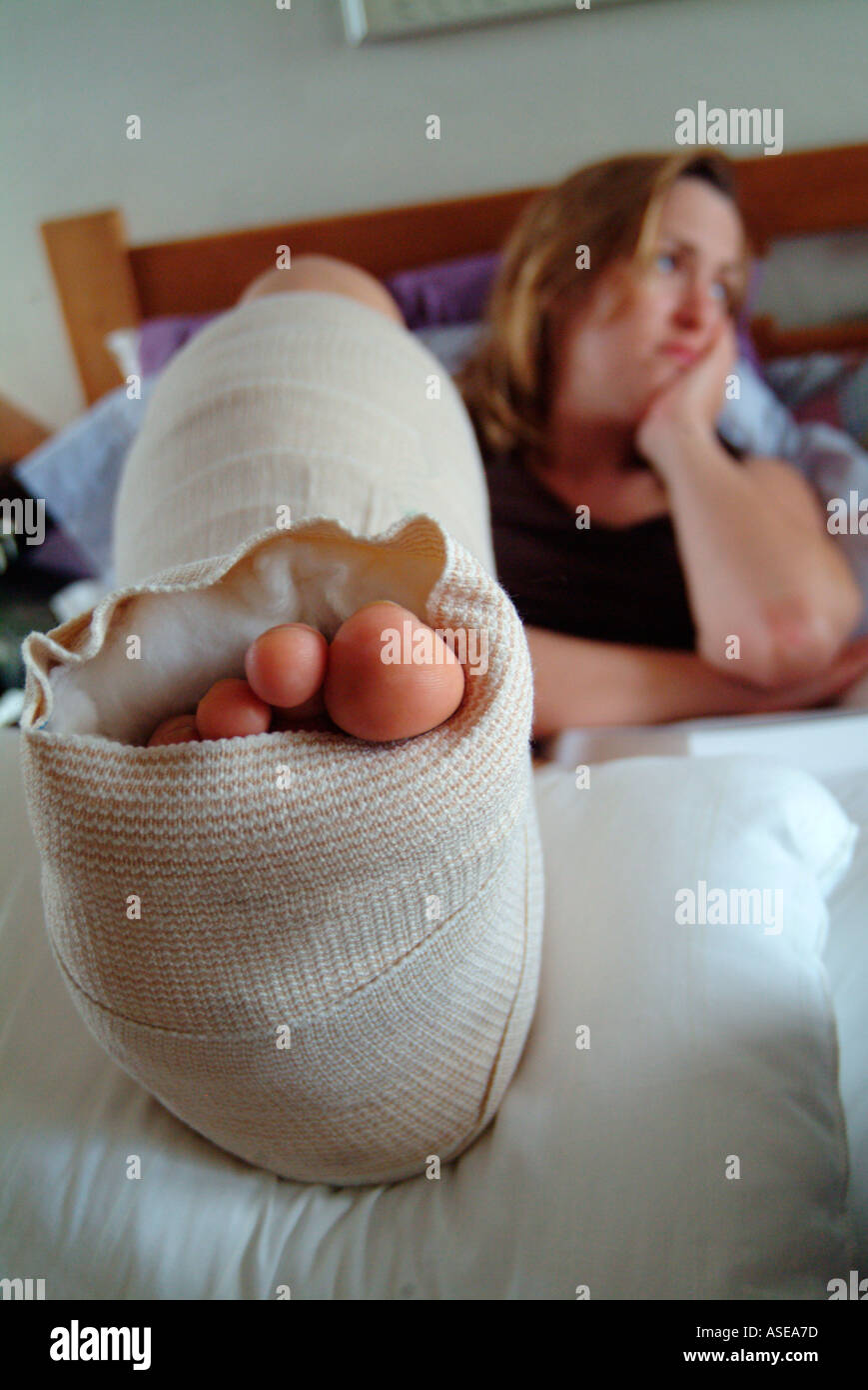 Woman with a cast on her leg rests in bed because of a foot injury
