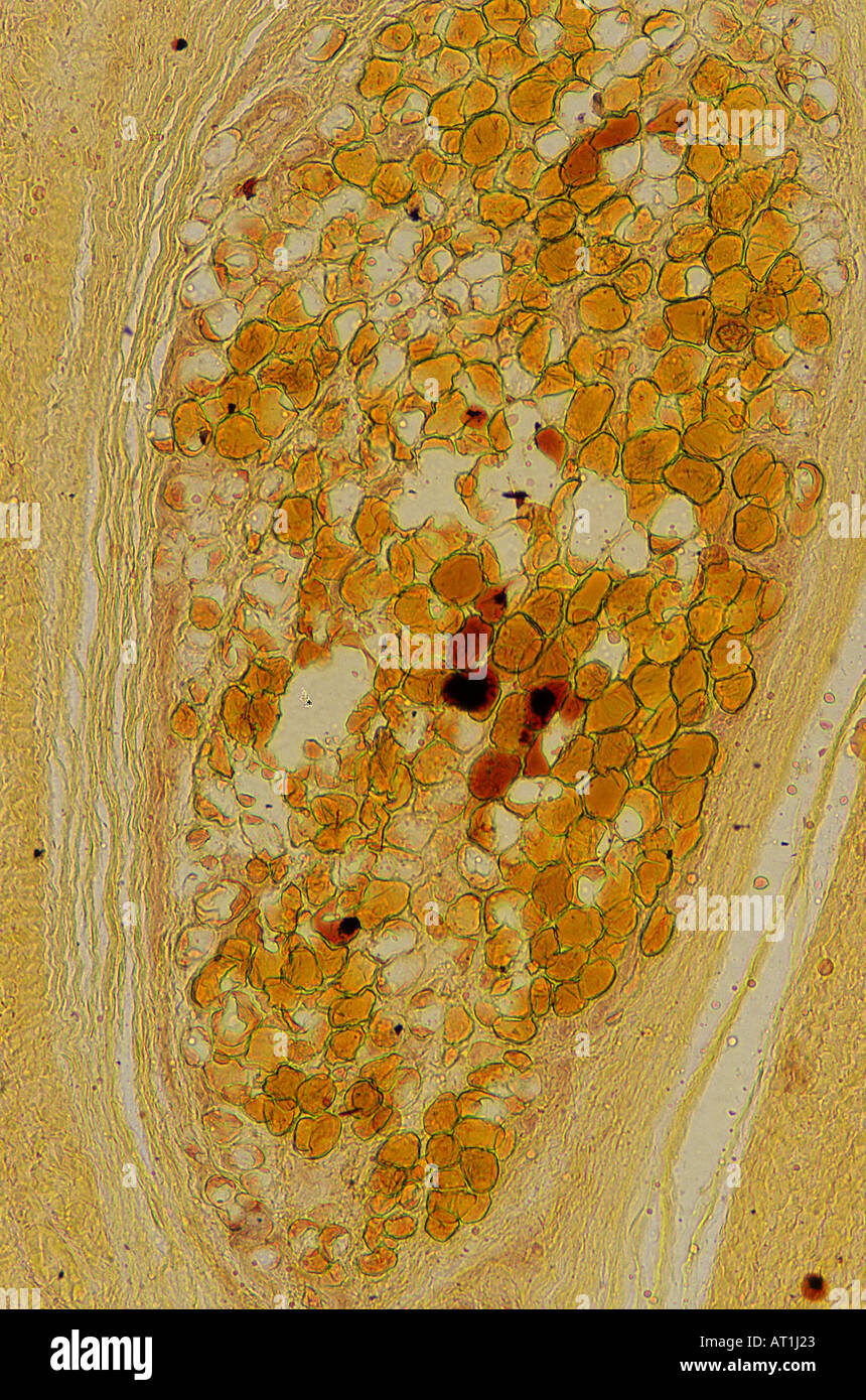 Adypocites Adipose tissue 35x Stock Photo