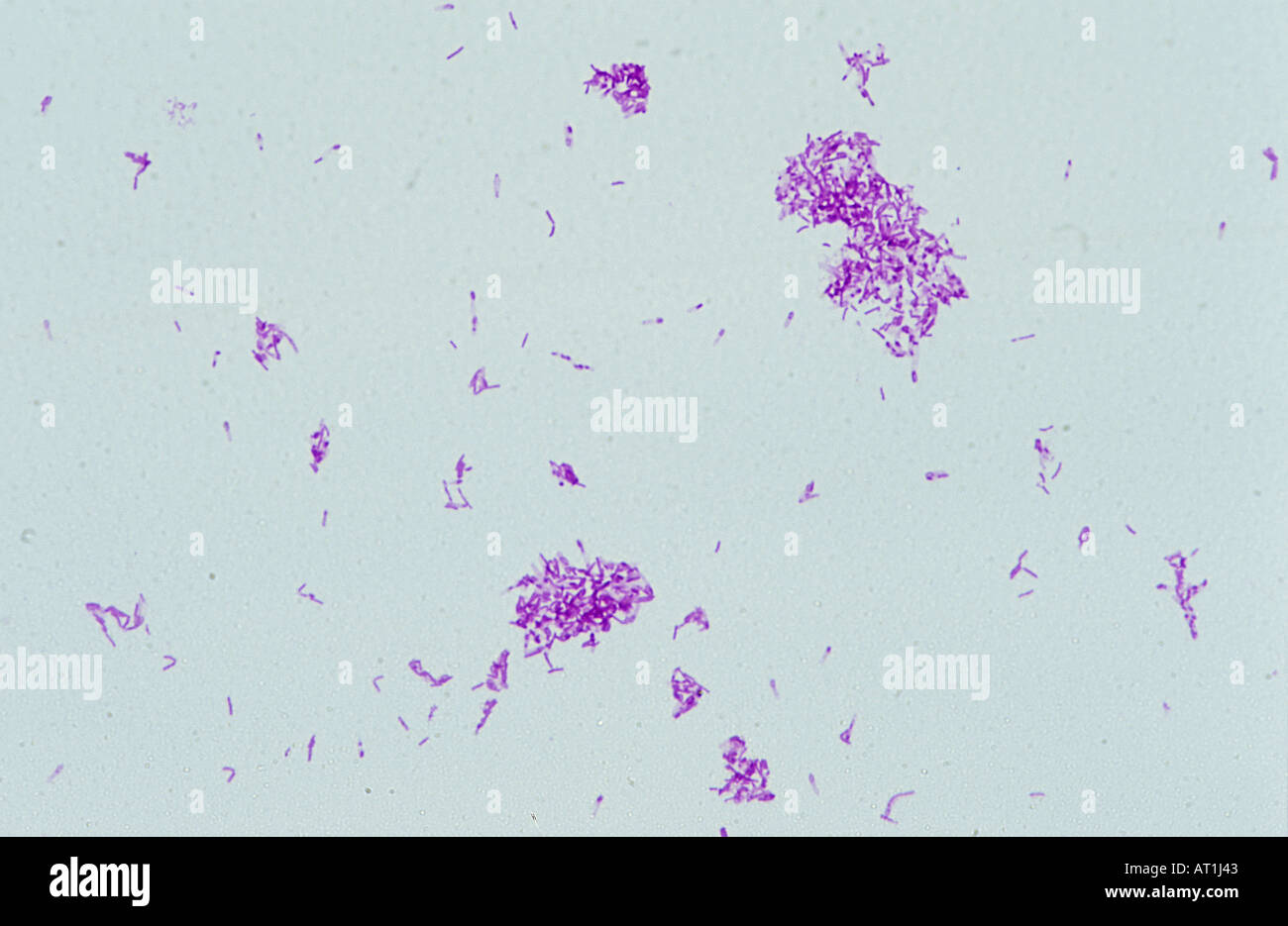Clostridium tetani Bactery of TetaniGram Stock Photo