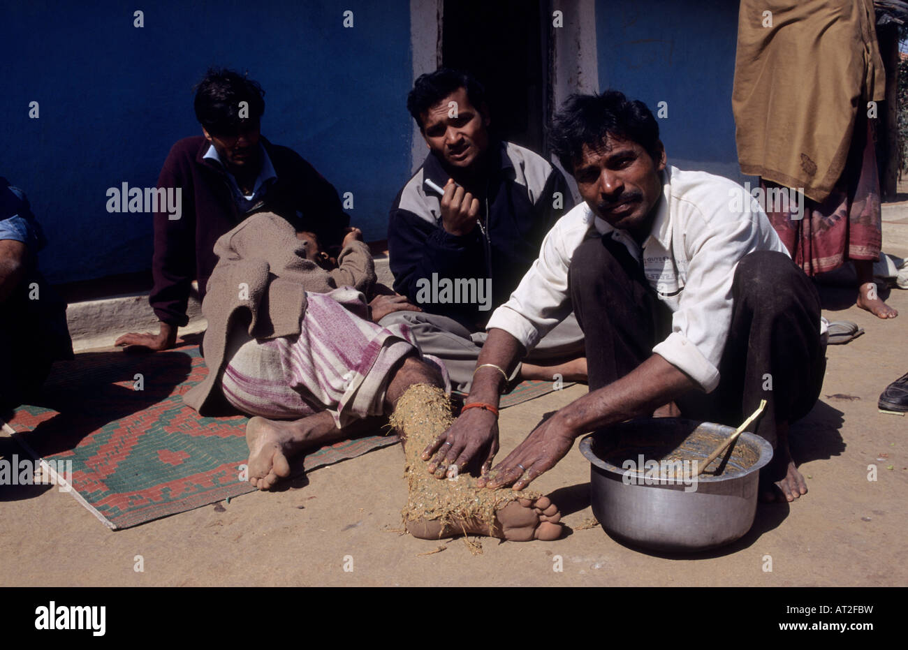Treatment of snake bite, applying herbal and mud paste at Ghughri Madhya Pradesh, India Stock Photo
