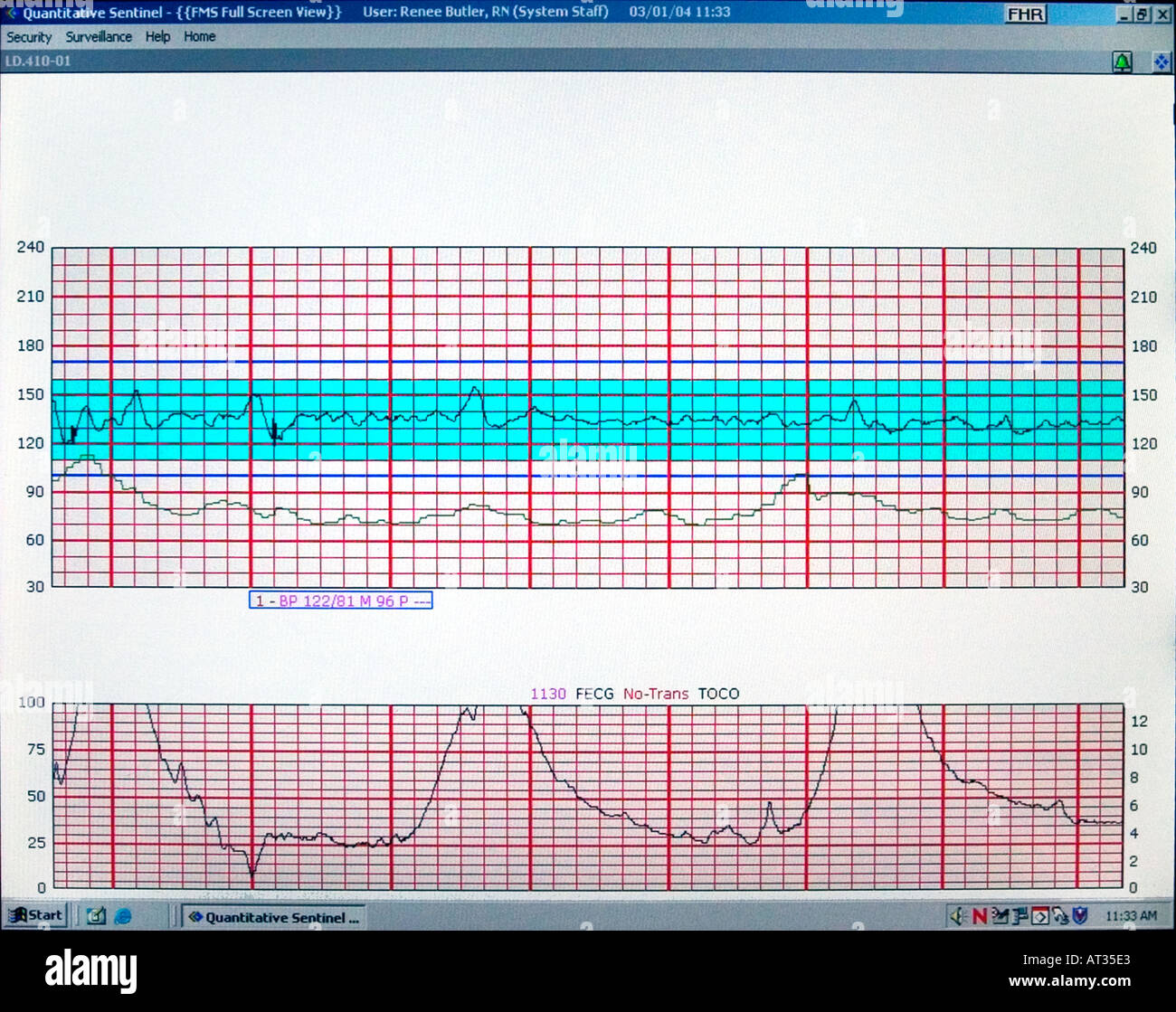 Computer screen monitoring vital signs and contractions of ...