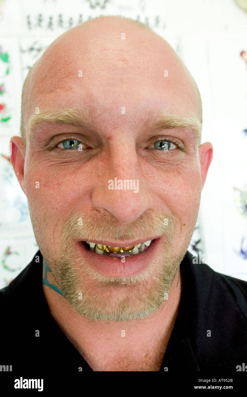 Bald headed adult male with gold teeth Stock Photo
