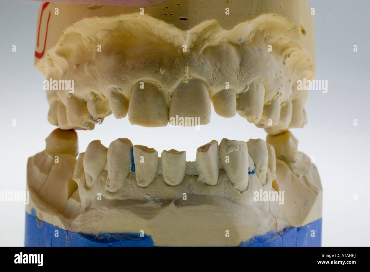 Modell für Zahnersatz, dental prostheses Stock Photo