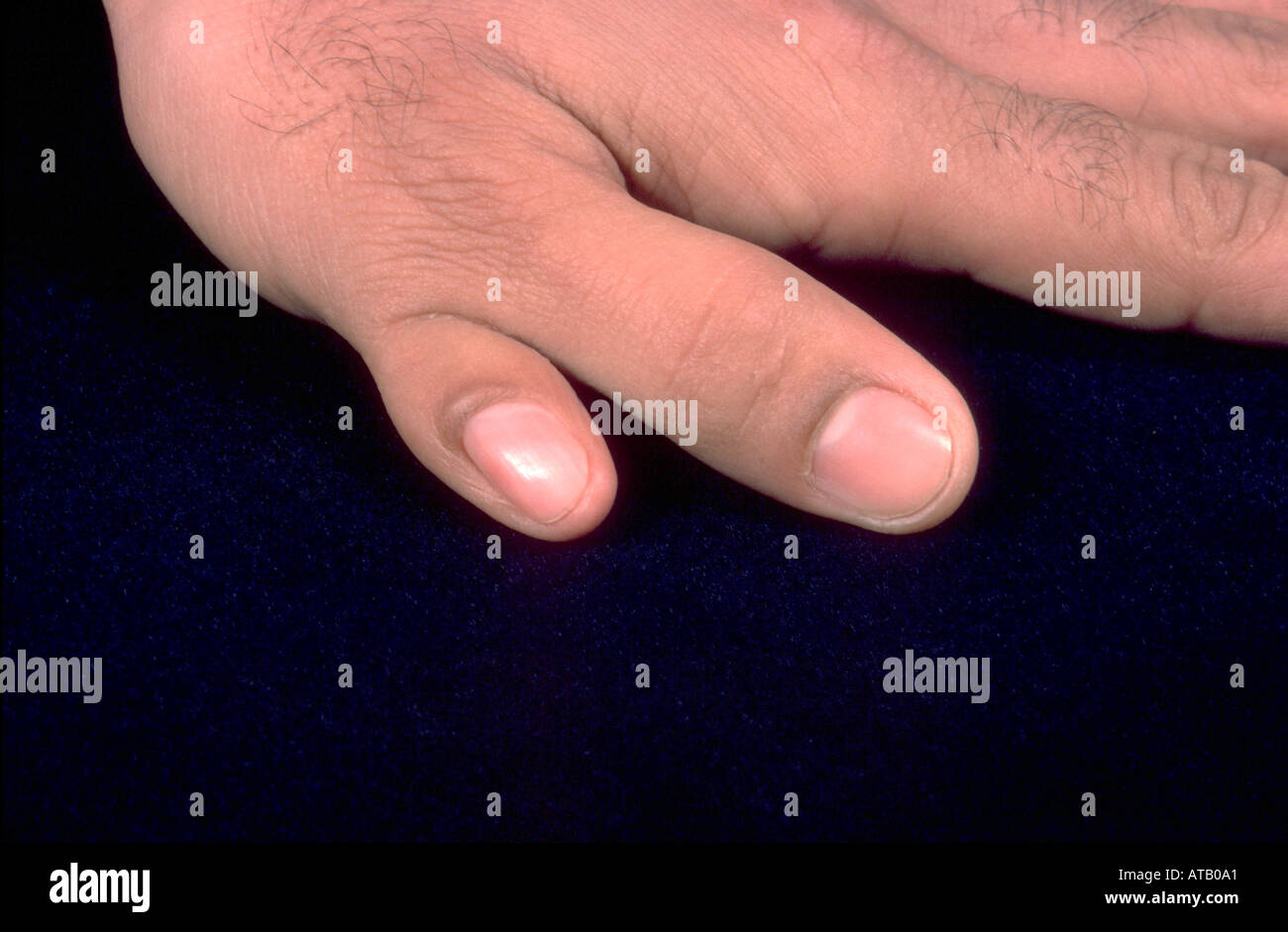 Extra hand hires stock photography and images Alamy