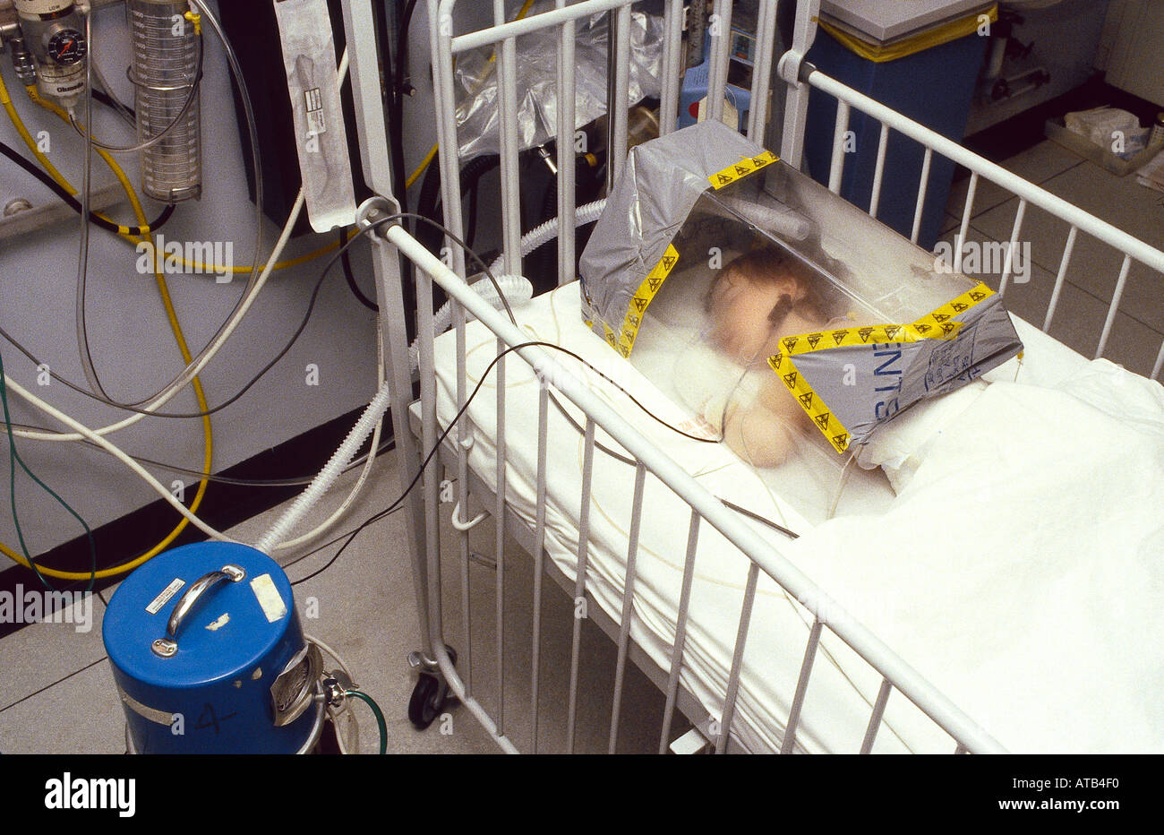 Child in oxygen mist tent for acute epiglottitis Stock Photo - Alamy