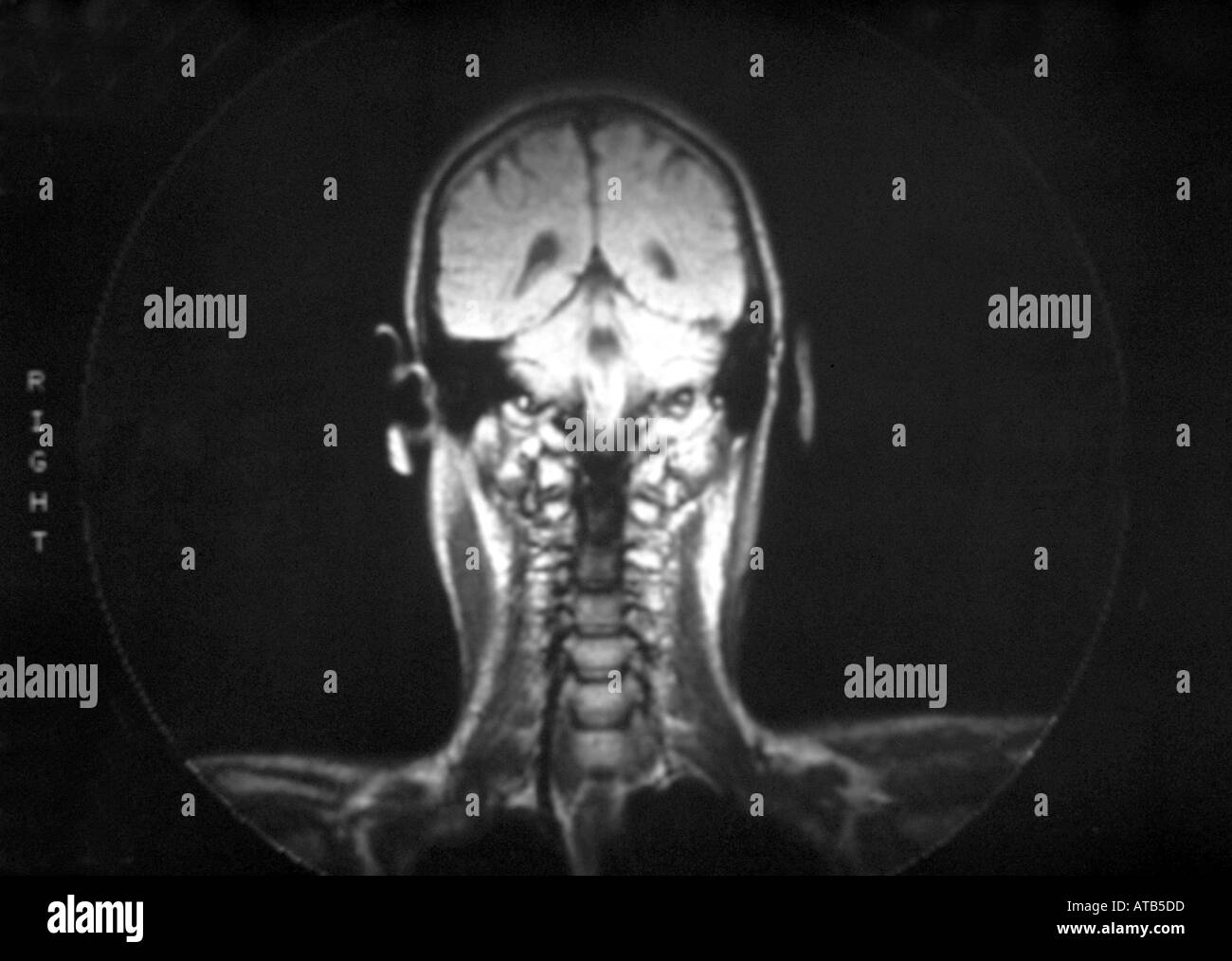 Normal anatomy NMR scan Stock Photo