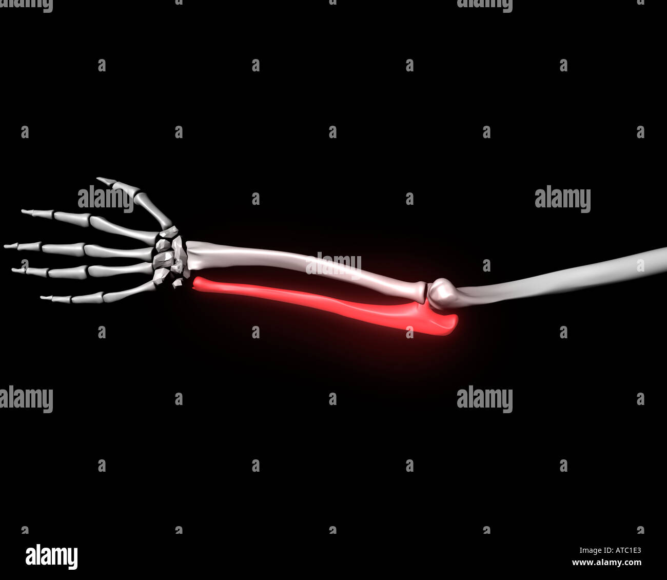 ulna bone highlighted red on human skeletal arm Stock Photo Alamy