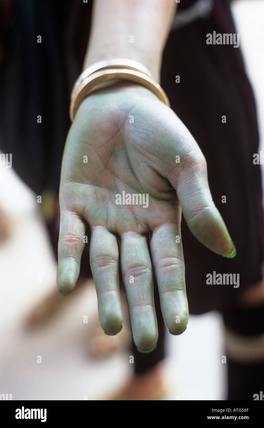 Hand dying hi-res stock photography and images - Alamy