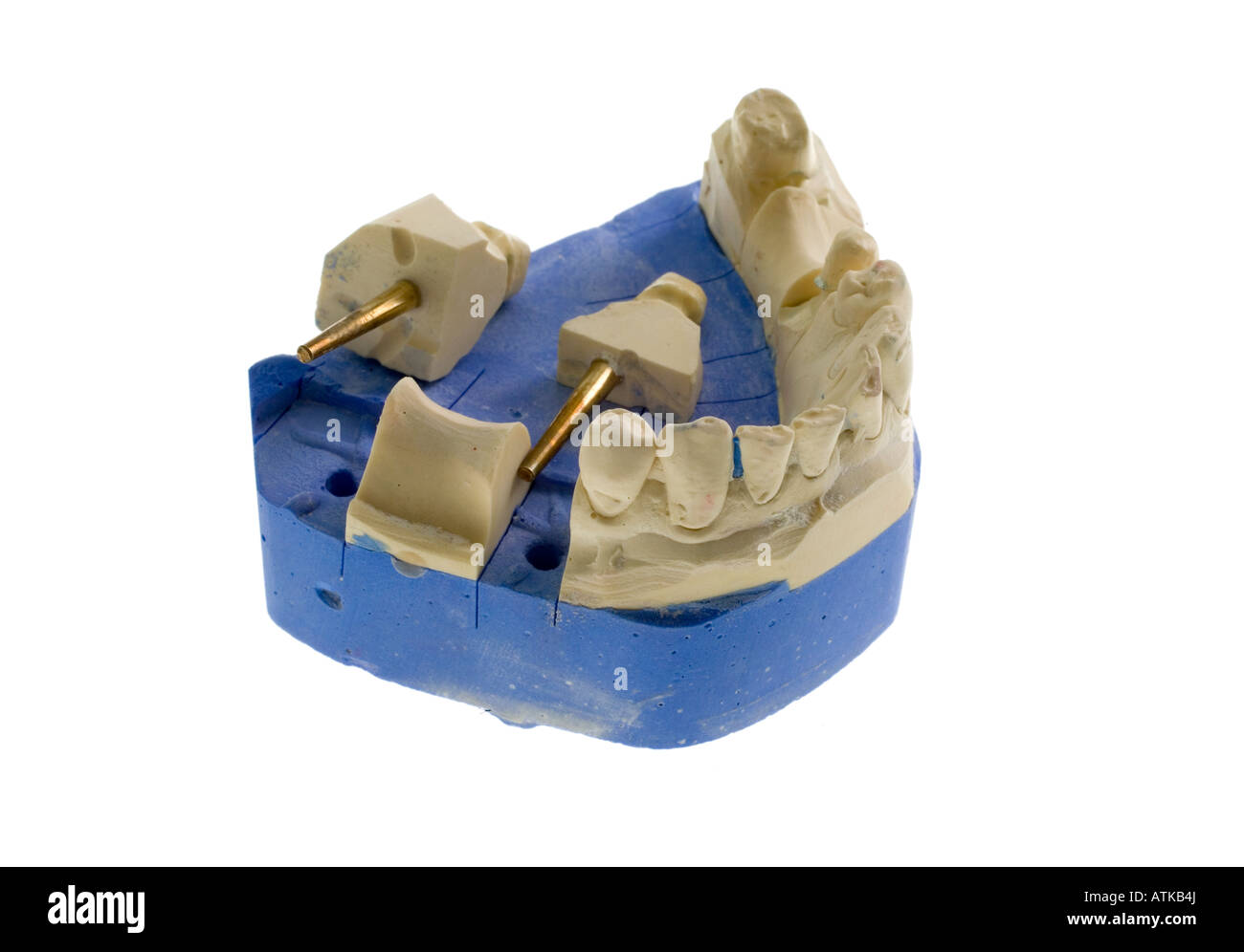 Modell für Zahnersatz dental prostheses Stock Photo