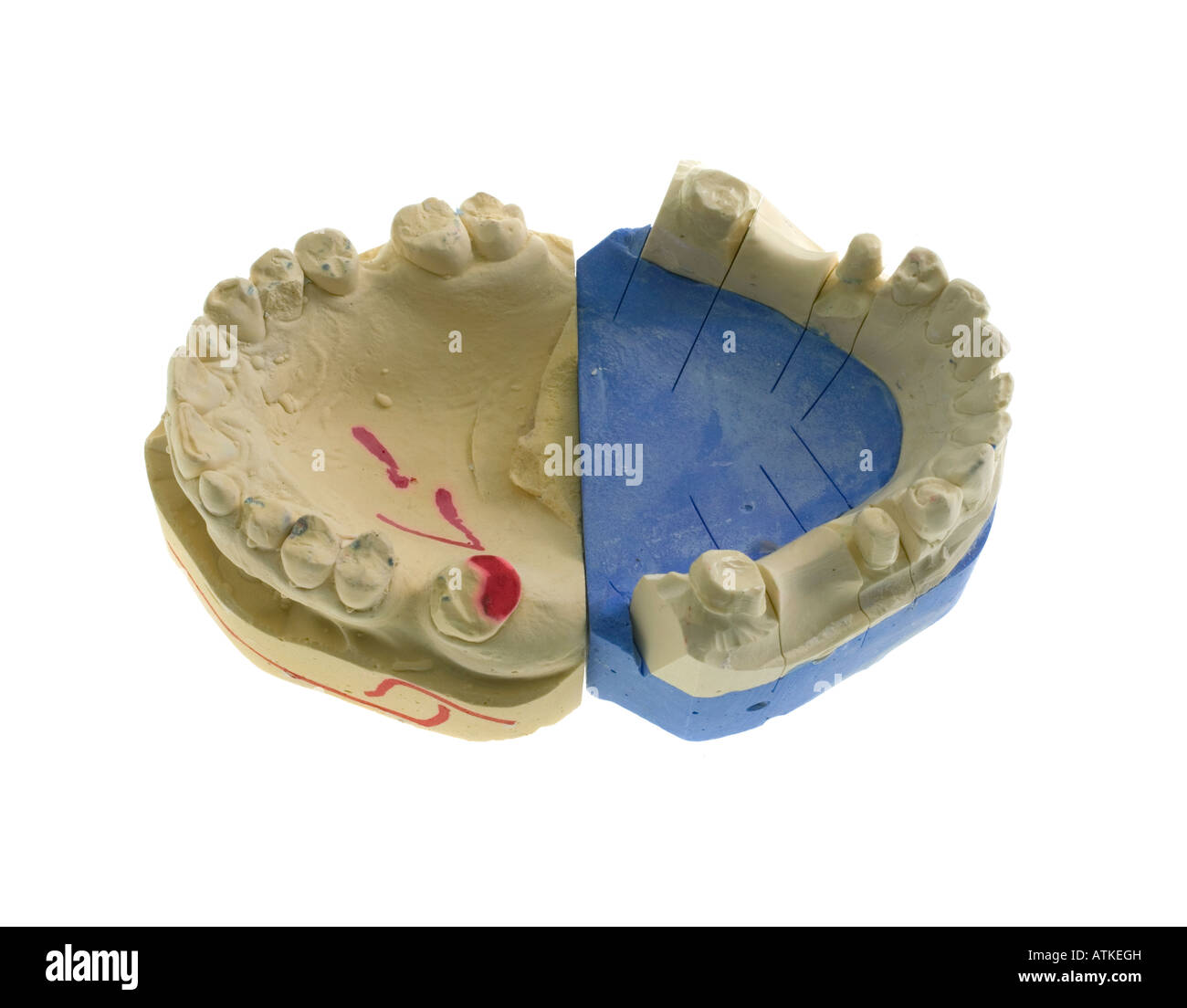 Modell für Zahnersatz dental prostheses Stock Photo